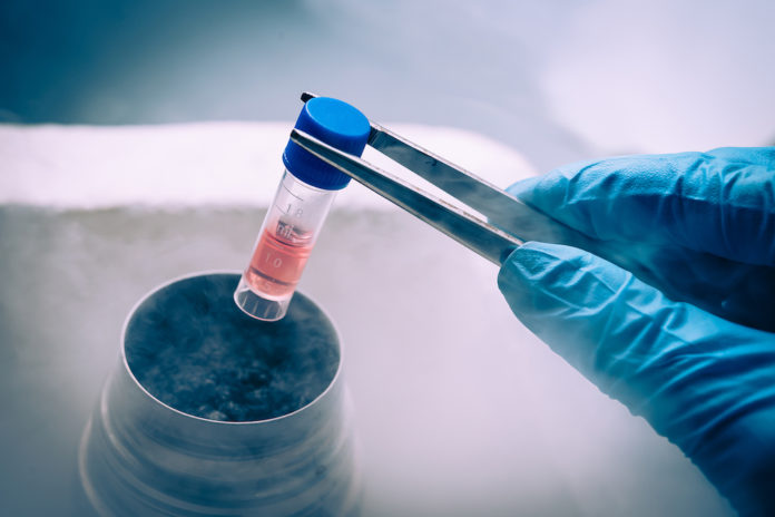 stem-cell_Elena-Pavlovich